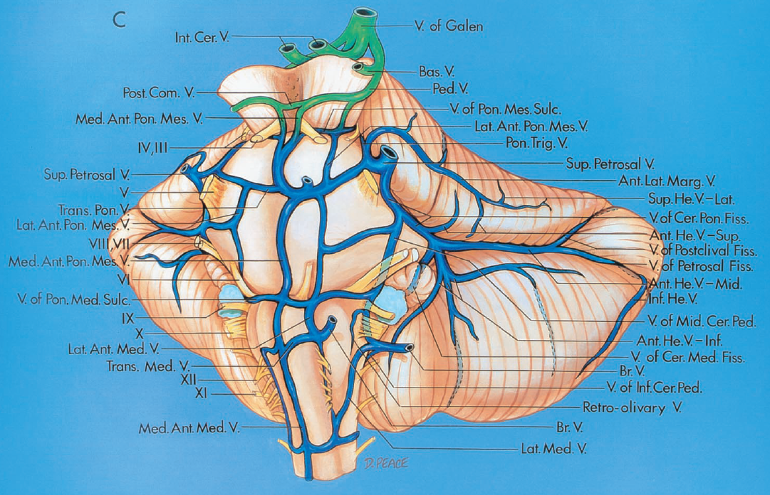 Bridging Vein anterior Brainstem Group Neuroangio Bridging Vein anterior Brainstem Group Neuroangio