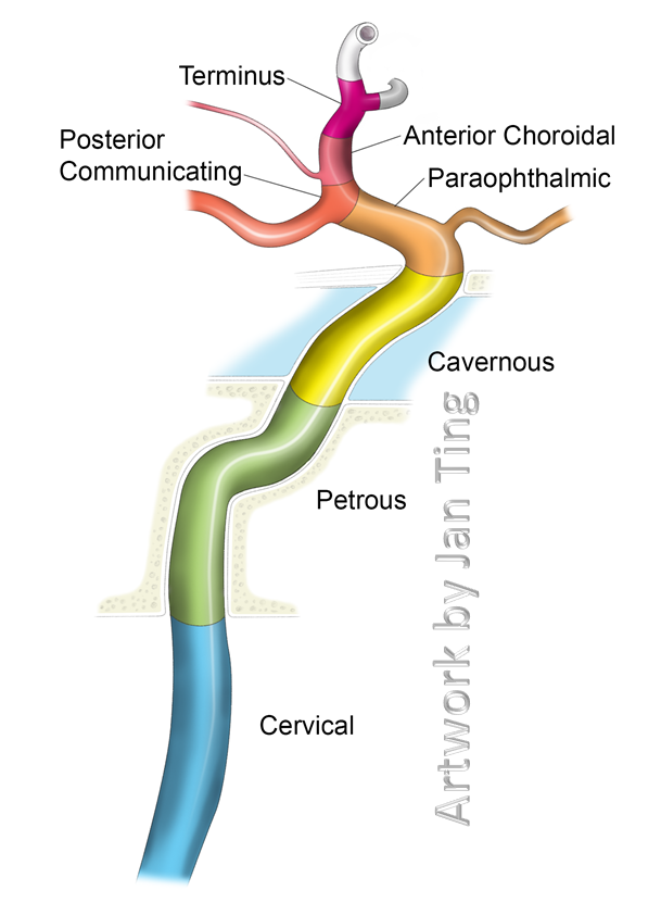 internal carotid artery in ear