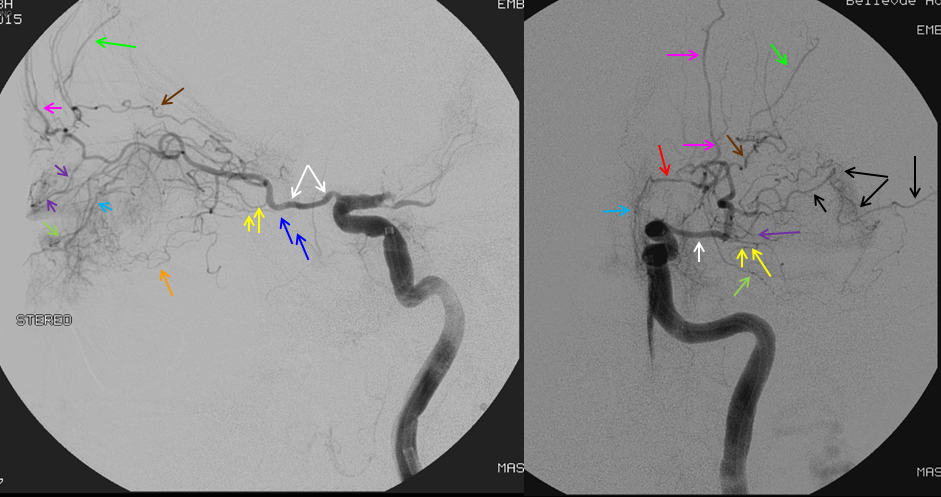 https://neuroangio.org/wp-content/uploads/Ophthalmic/Ophthalmic_intraorbital_branches_labels.png