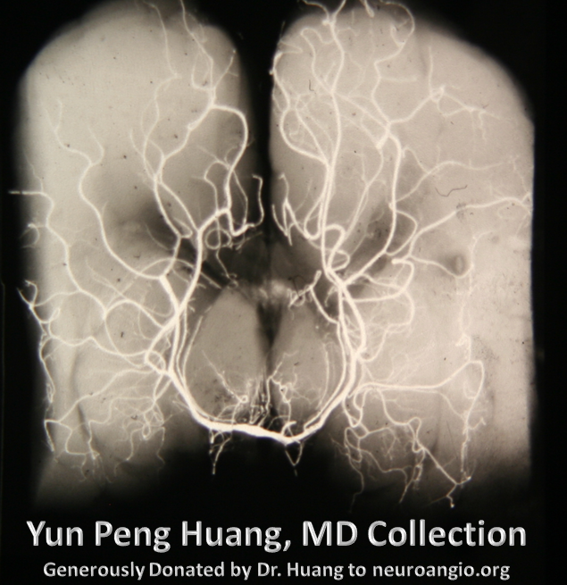 PSA x-ray specimen Yung Peng Huang Collection