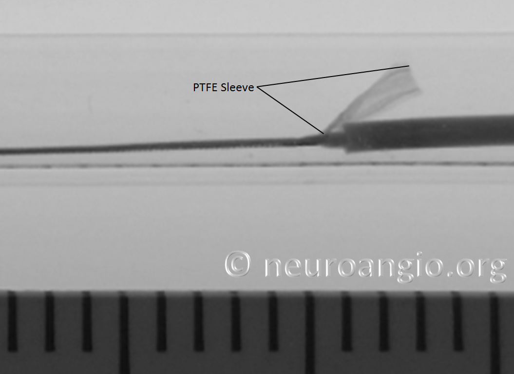 https://neuroangio.org/wp-content/uploads/PED/PED_Flex_Delivery_Tube_6.png