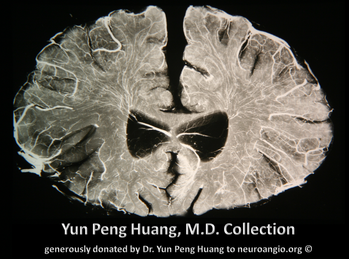 Yun Peng Huang Collection Frontal Specimen Medullary Veins Cord Homology