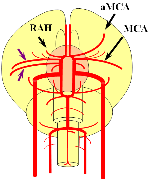 Posterior Cerebral Artery Neuroangio Org 2020 Anatomi - Bank2home.com